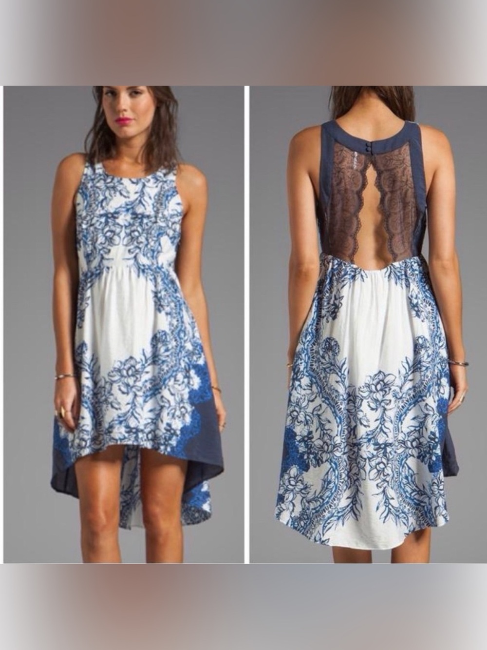 Free People Russian Plate Blue and White Floral Lace-Back Hi-Low Dress. Size XS